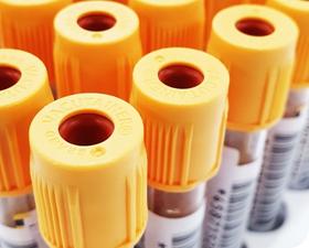 Photograph of yellow-top blood tubes containing blood samples, with barcodes on the sides.